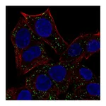 Atlas Antibodies Anti-ABT1 Antibody