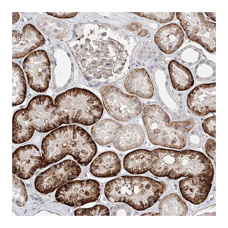 Atlas Antibodies Anti-ABLIM2 Antibody