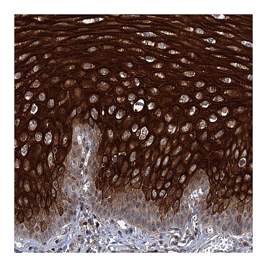 Atlas Antibodies Anti-ABLIM1 Antibody