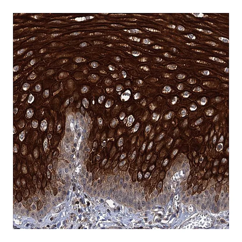 Atlas Antibodies Anti-ABLIM1 Antibody