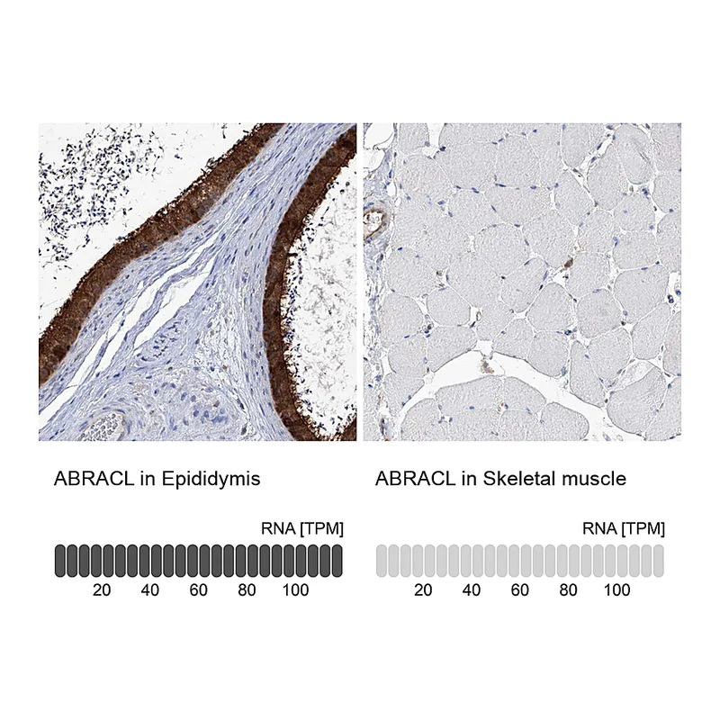 Atlas Antibodies Anti-ABRACL Antibody