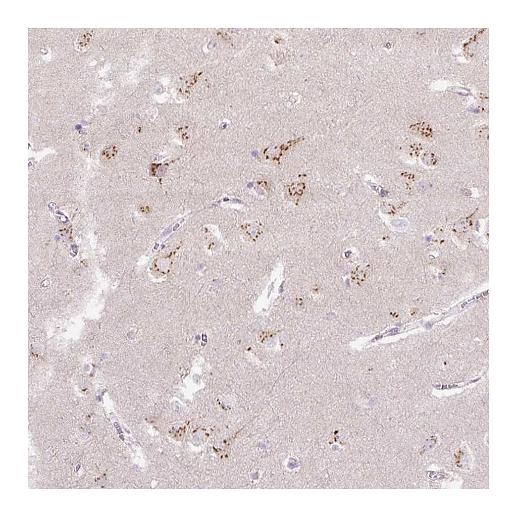 Atlas Antibodies Anti-ABR Antibody