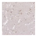 Atlas Antibodies Anti-ABR Antibody