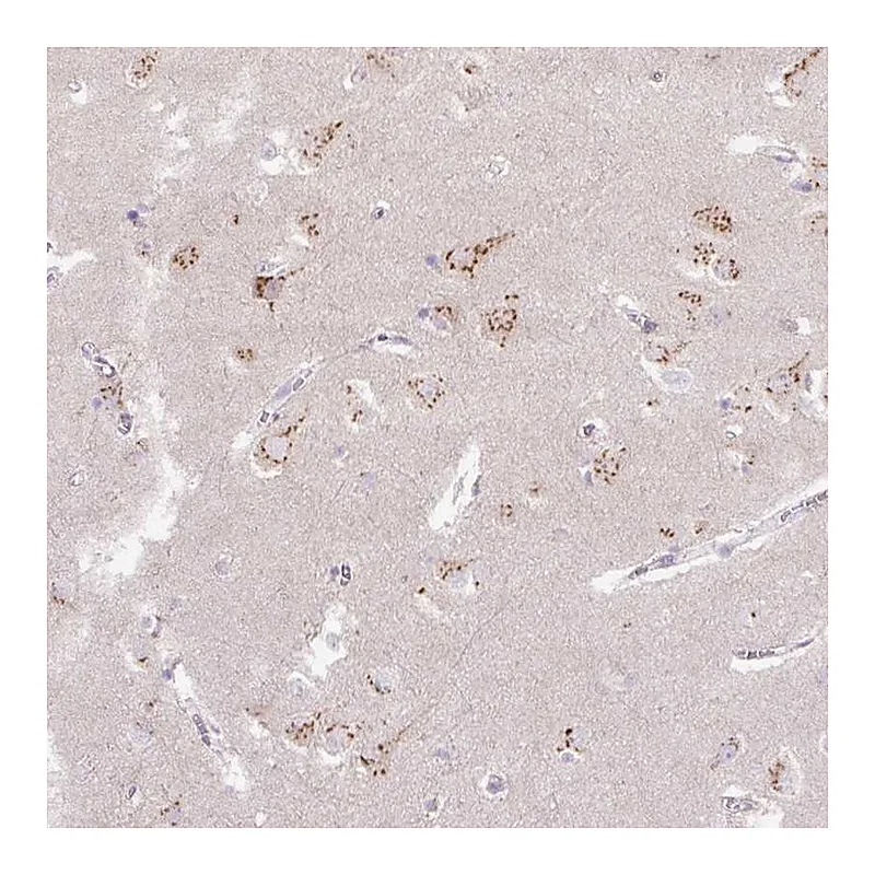 Atlas Antibodies Anti-ABR Antibody