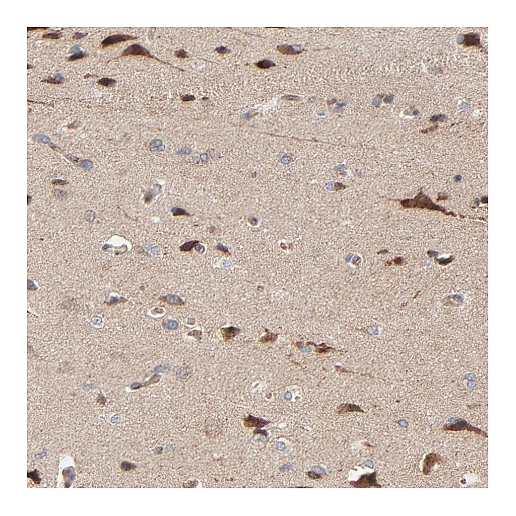 Atlas Antibodies Anti-ABLIM3 Antibody