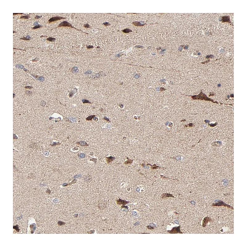 Atlas Antibodies Anti-ABLIM3 Antibody