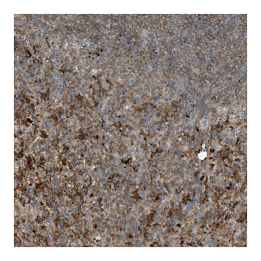 Atlas Antibodies Anti-ABTB1 Antibody