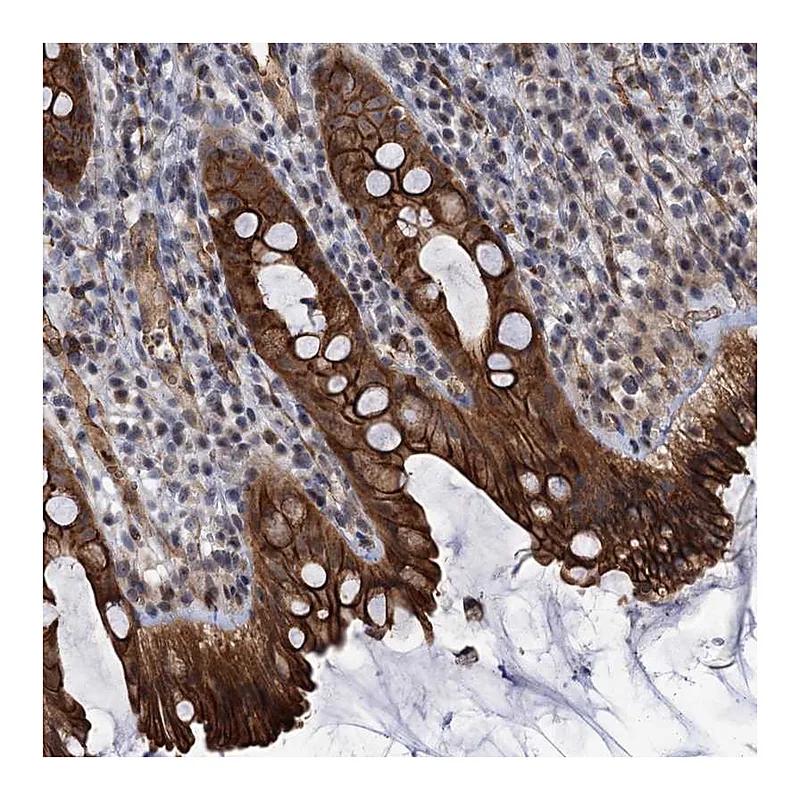 Atlas Antibodies Anti-ABLIM1 Antibody