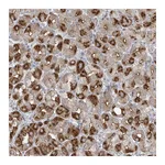 Atlas Antibodies Anti-ABTB1 Antibody