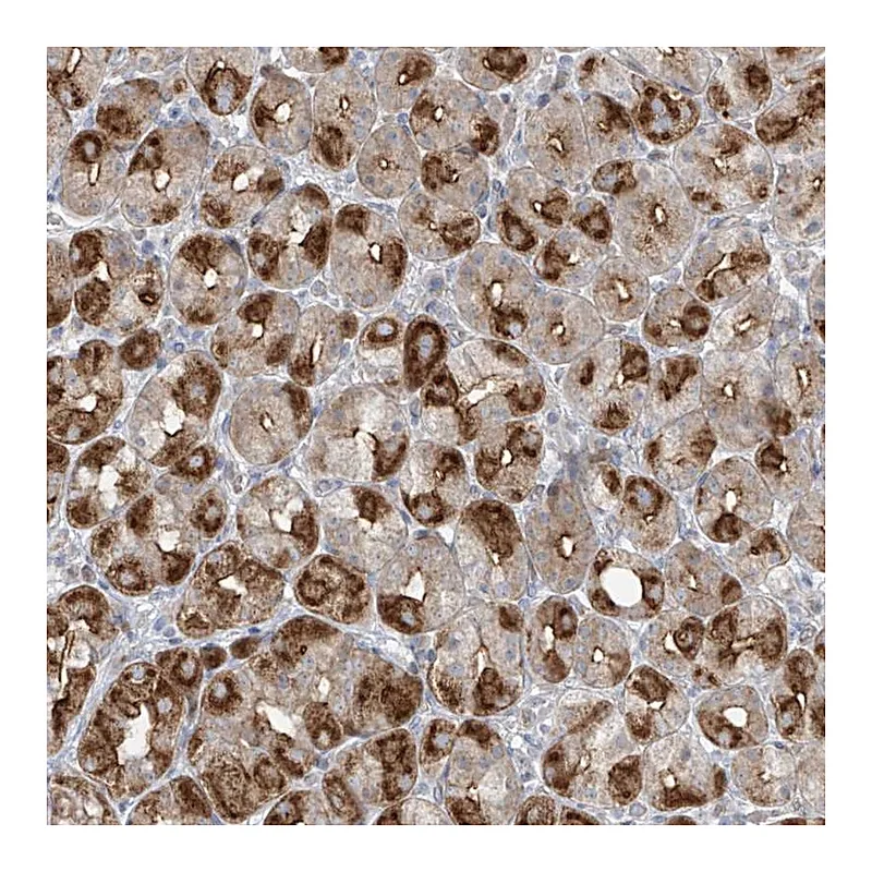 Atlas Antibodies Anti-ABTB1 Antibody
