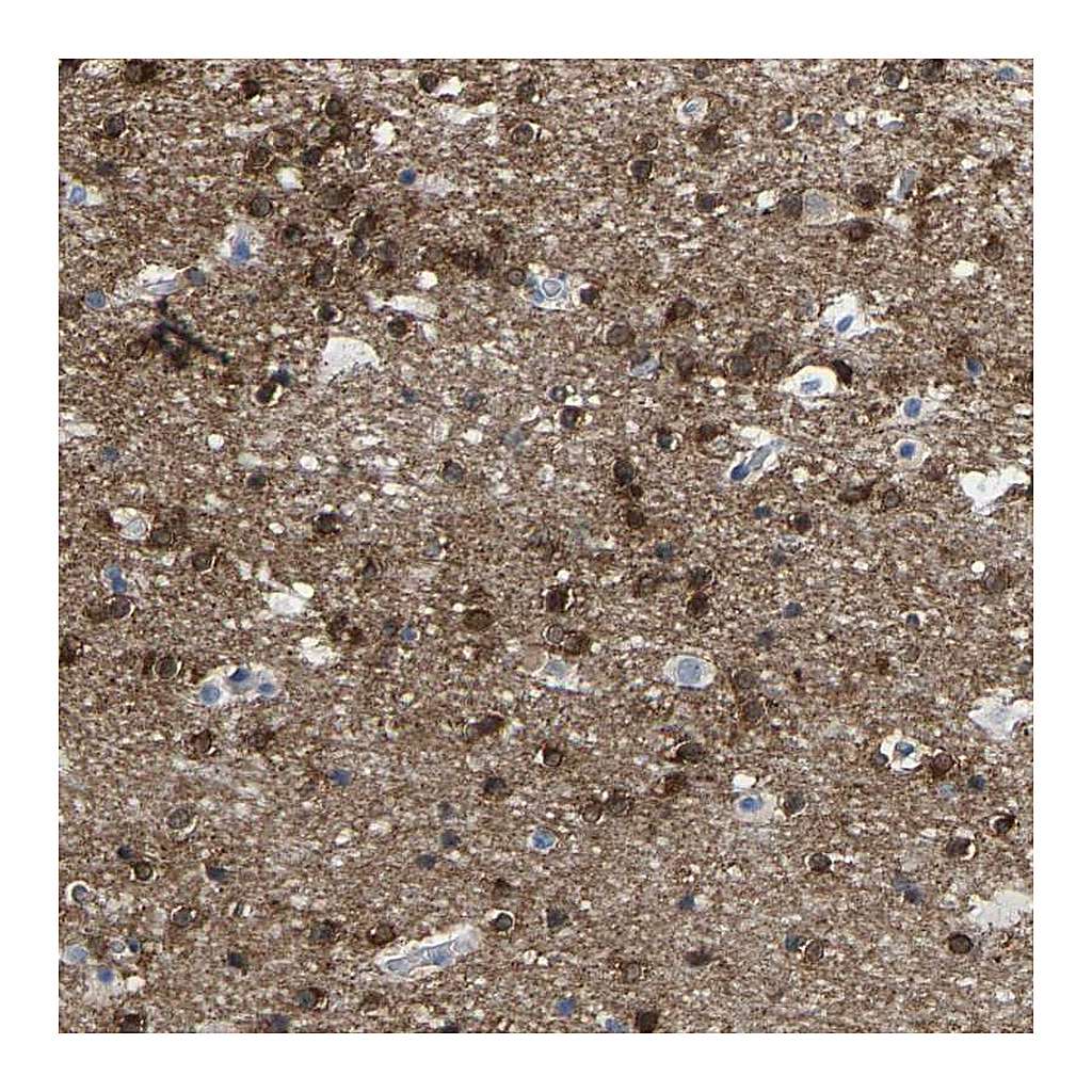 Atlas Antibodies Anti-ABTB2 Antibody