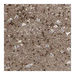 Atlas Antibodies Anti-ABTB2 Antibody
