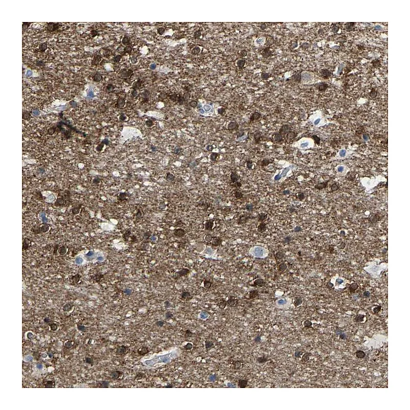 Atlas Antibodies Anti-ABTB2 Antibody