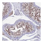 Atlas Antibodies Anti-AC004381.6 Antibody