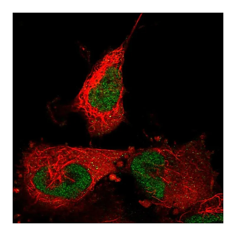 Atlas Antibodies Anti-ABTB2 Antibody