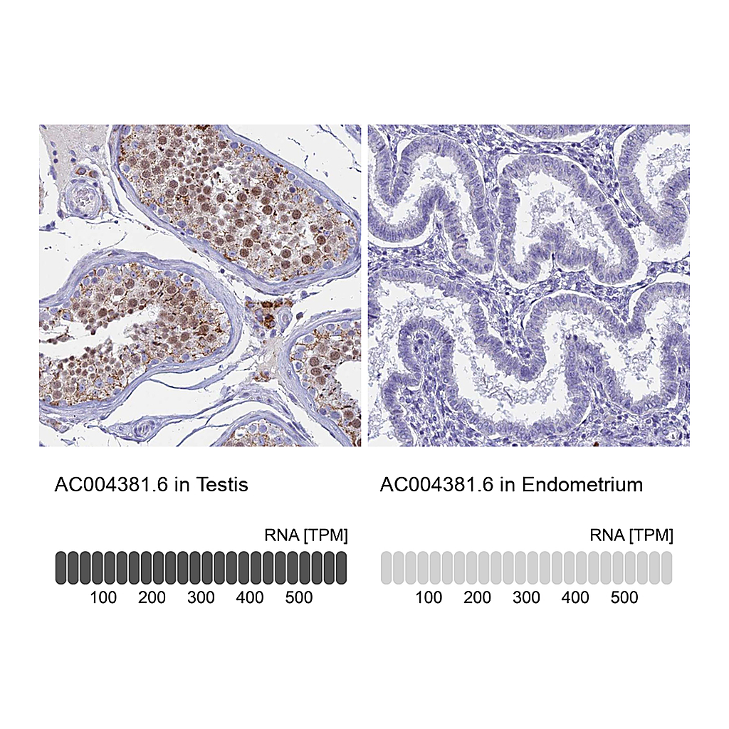 Atlas Antibodies Anti-AC004381.6 Antibody