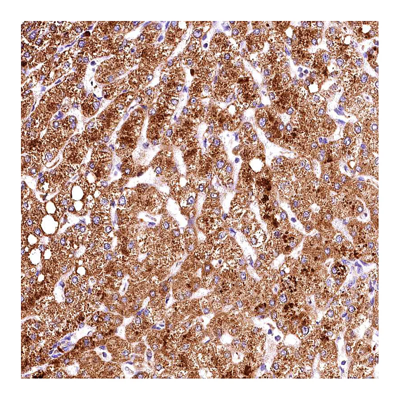 Atlas Antibodies Anti-ACAA2 Antibody