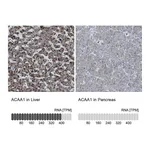 Atlas Antibodies Anti-ACAA1 Antibody