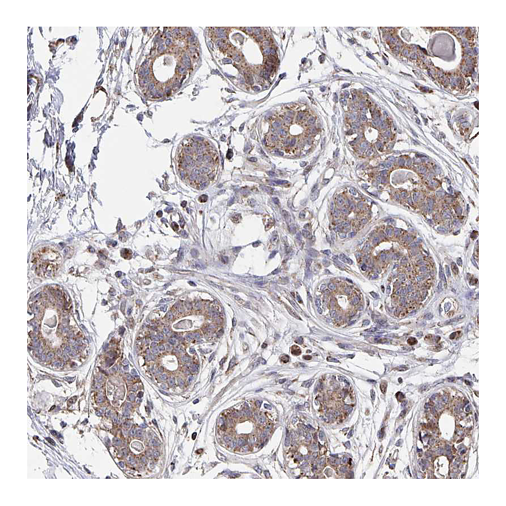 Atlas Antibodies Anti-ACACA Antibody