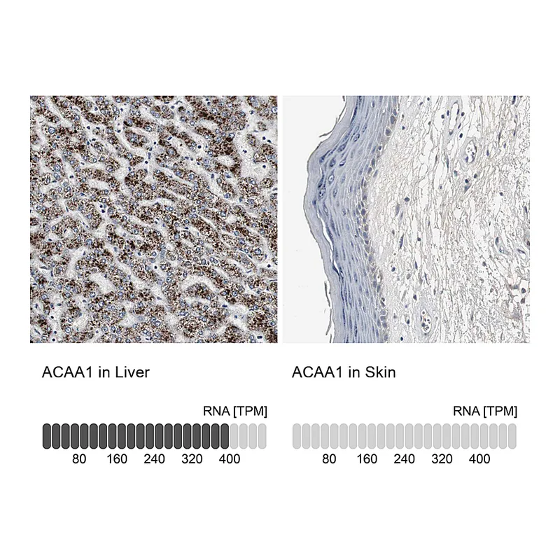 Atlas Antibodies Anti-ACAA1 Antibody