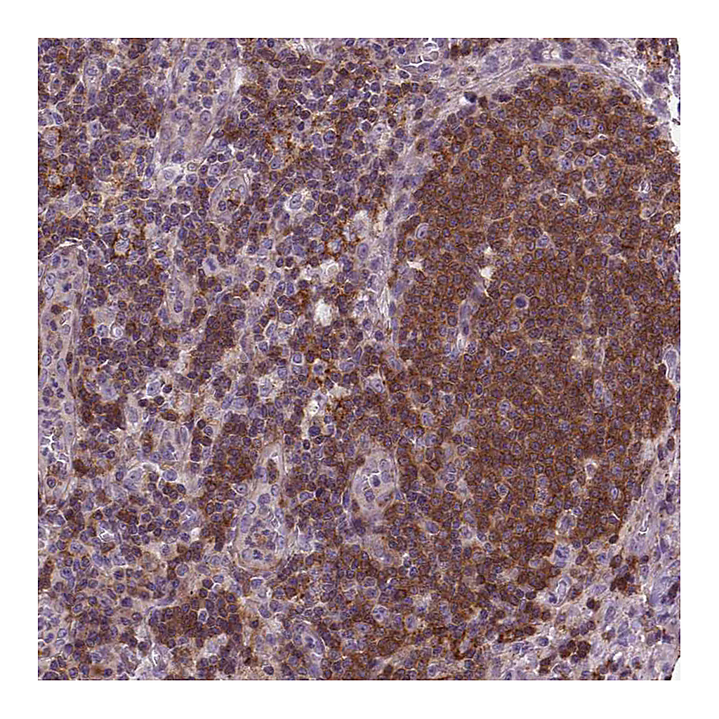 Atlas Antibodies Anti-ACAD10 Antibody