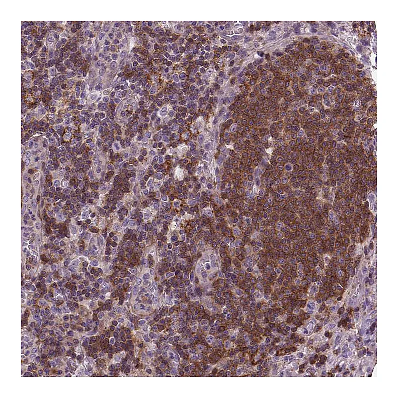 Atlas Antibodies Anti-ACAD10 Antibody