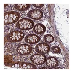 Atlas Antibodies Anti-ACAD8 Antibody
