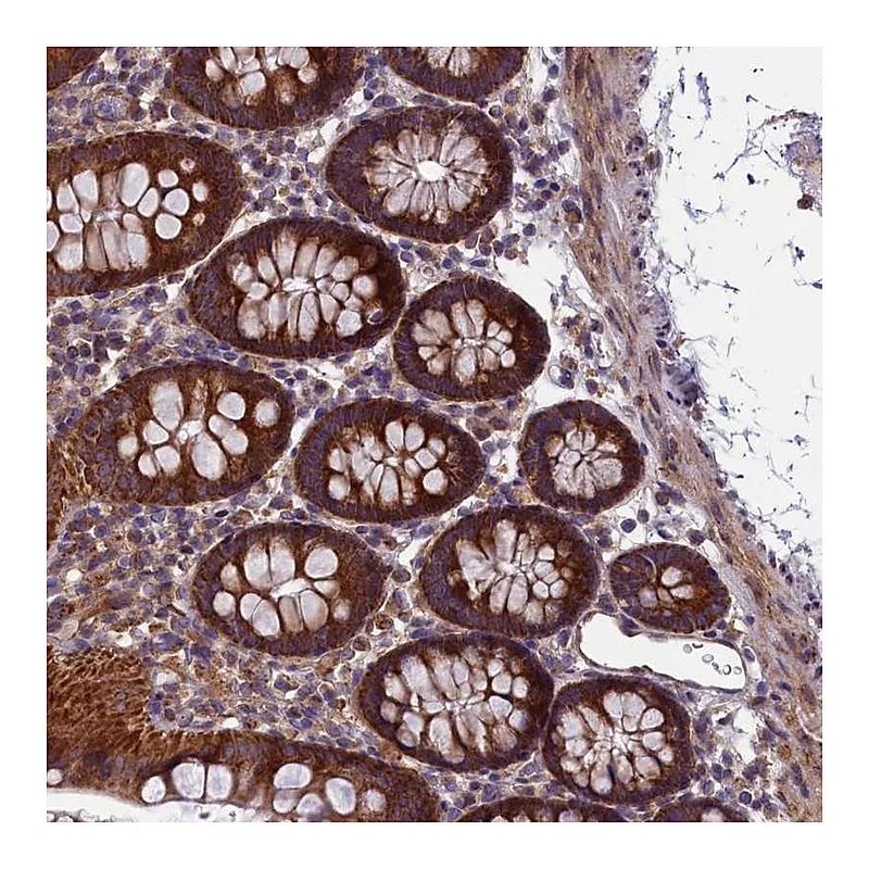 Atlas Antibodies Anti-ACAD8 Antibody