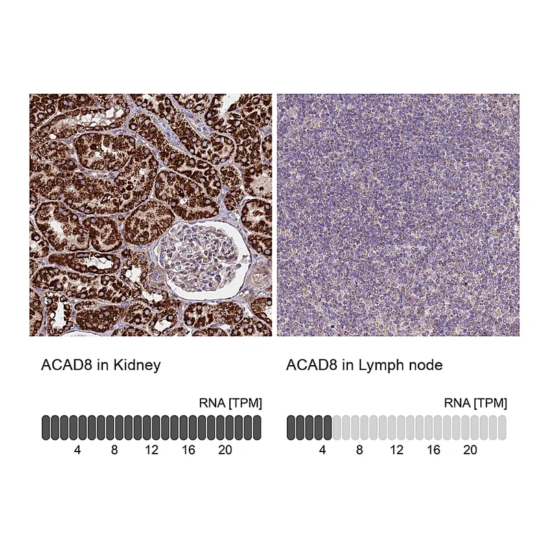 Atlas Antibodies Anti-ACAD8 Antibody