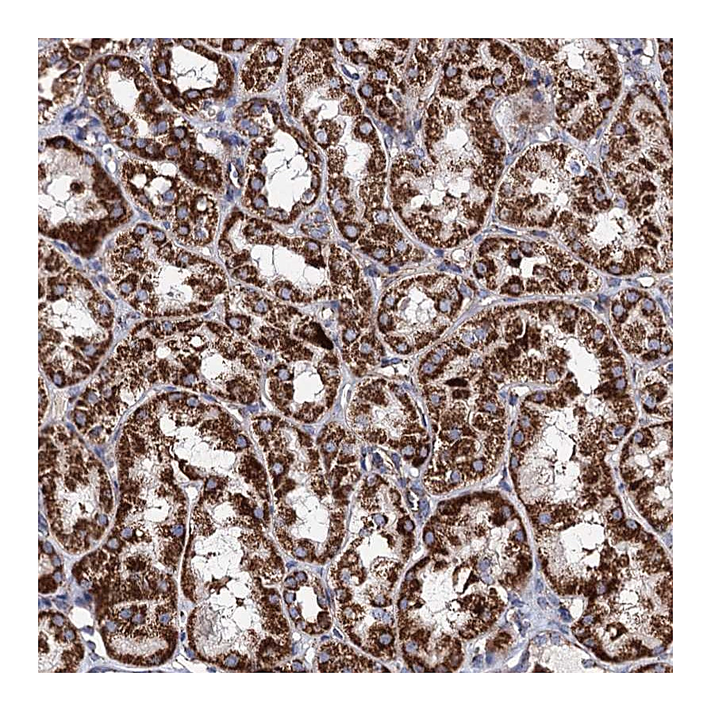 Atlas Antibodies Anti-ACAD9 Antibody