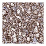Atlas Antibodies Anti-ACAD9 Antibody