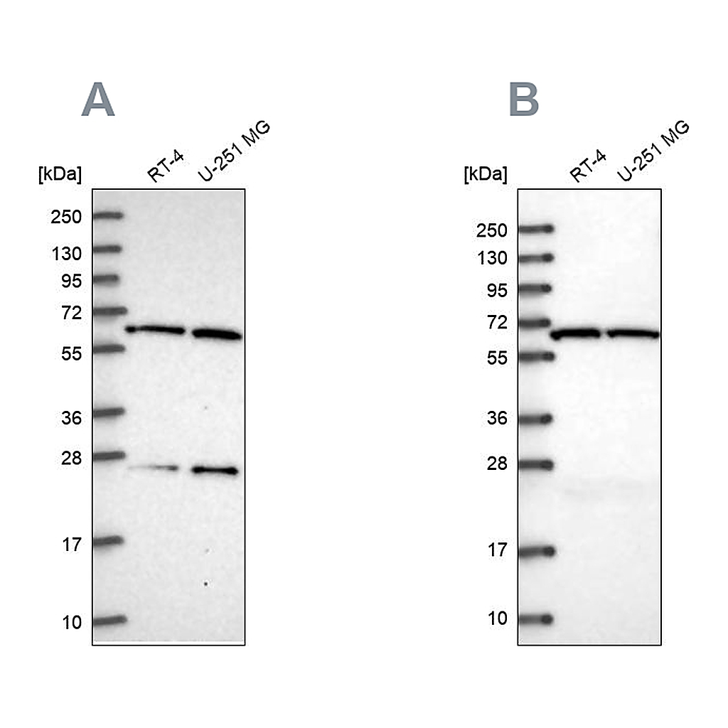 Atlas Antibodies Anti-ACAD9 Antibody