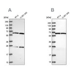 Atlas Antibodies Anti-ACAD9 Antibody