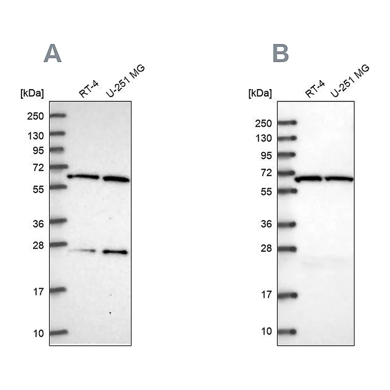 Atlas Antibodies Anti-ACAD9 Antibody