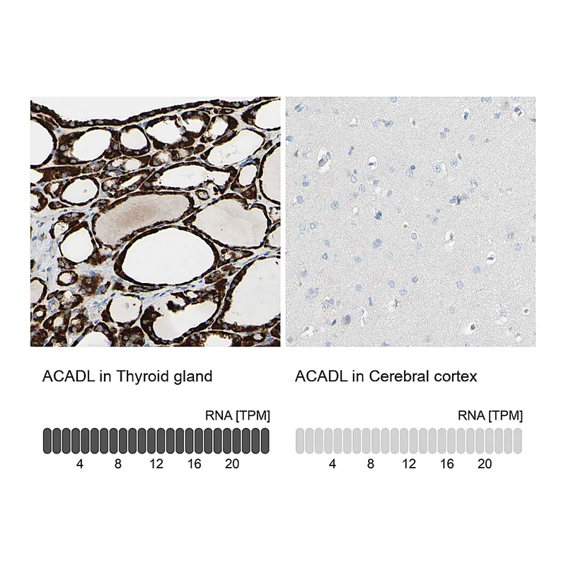 Atlas Antibodies Anti-ACADL Antibody