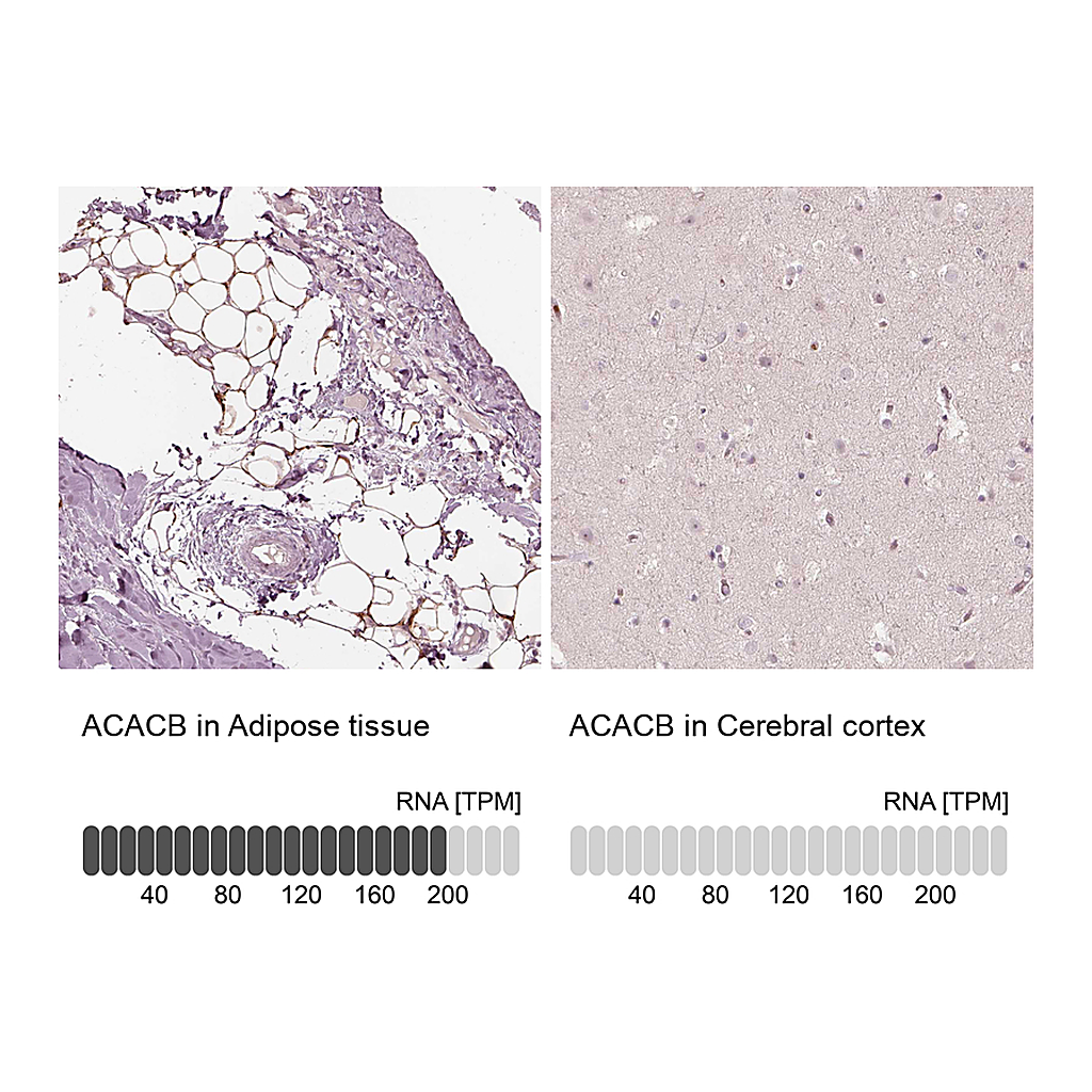 Atlas Antibodies Anti-ACACB Antibody