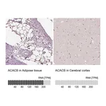 Atlas Antibodies Anti-ACACB Antibody
