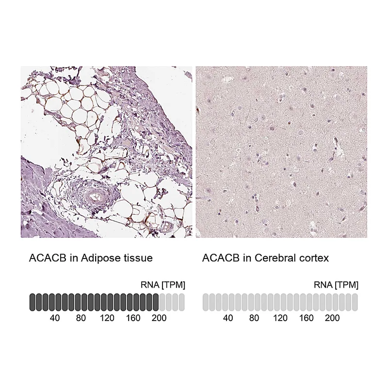 Atlas Antibodies Anti-ACACB Antibody