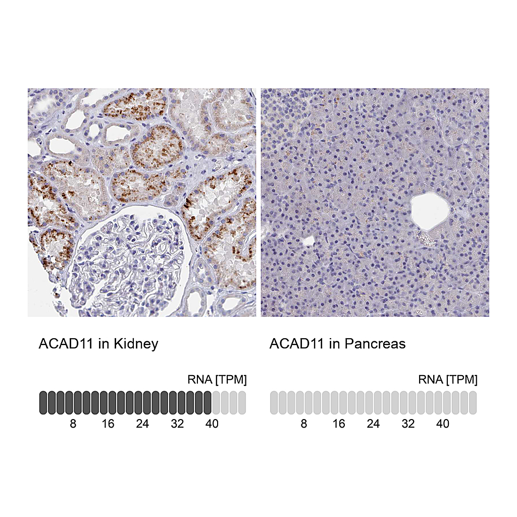 Atlas Antibodies Anti-ACAD11 Antibody