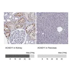 Atlas Antibodies Anti-ACAD11 Antibody
