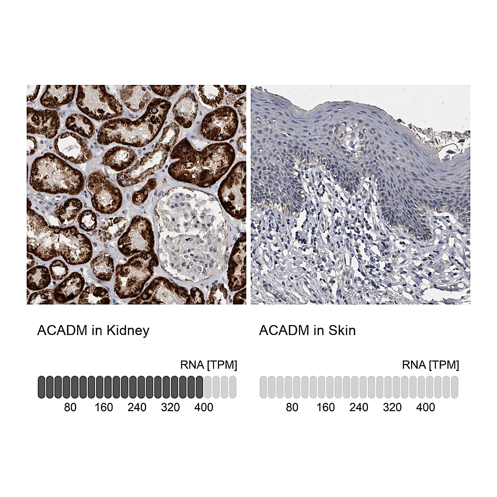 Atlas Antibodies Anti-ACADM Antibody