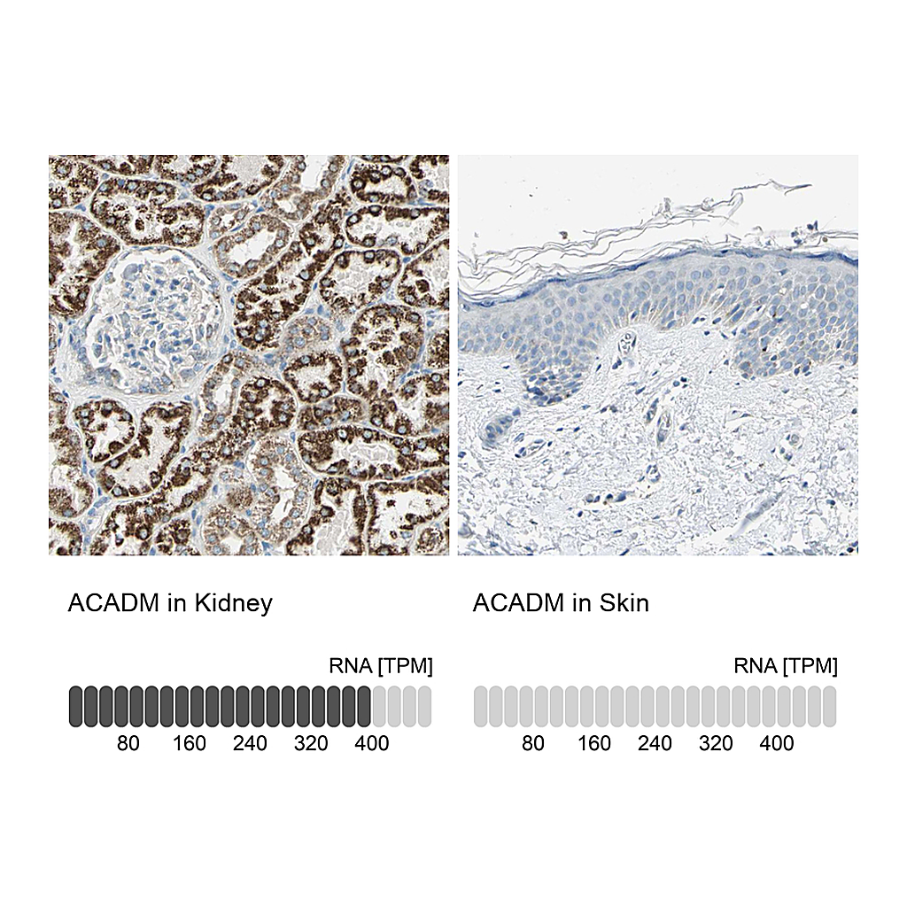 Atlas Antibodies Anti-ACADM Antibody