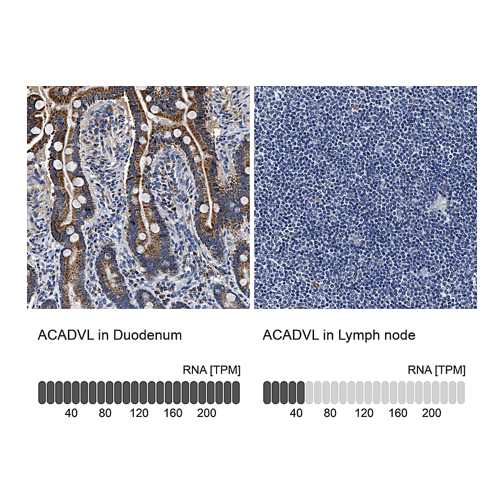 Atlas Antibodies Anti-ACADVL Antibody