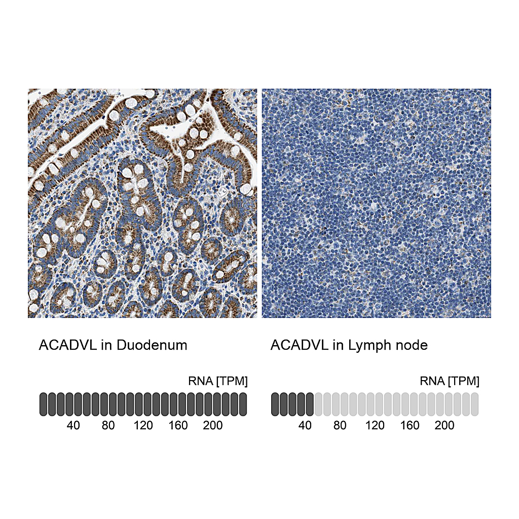 Atlas Antibodies Anti-ACADVL Antibody
