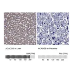 Atlas Antibodies Anti-ACADSB Antibody