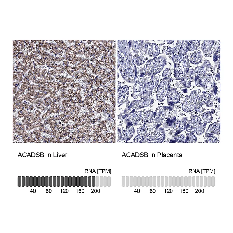 Atlas Antibodies Anti-ACADSB Antibody