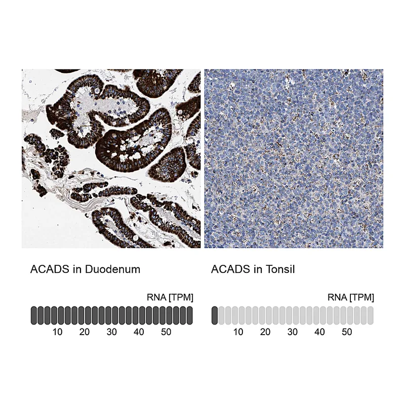 Atlas Antibodies Anti-ACADS Antibody