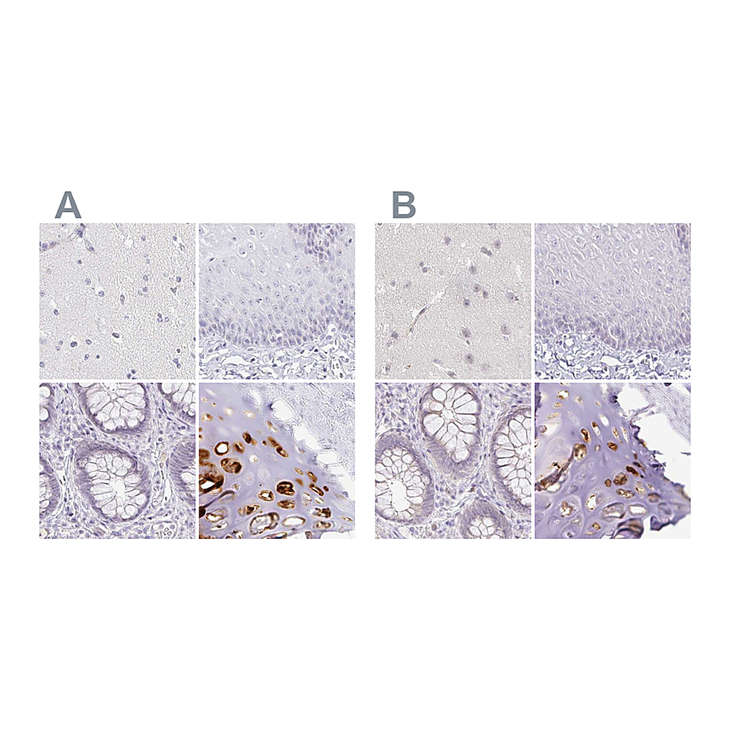 Atlas Antibodies Anti-ACAN Antibody