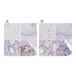 Atlas Antibodies Anti-ACAN Antibody