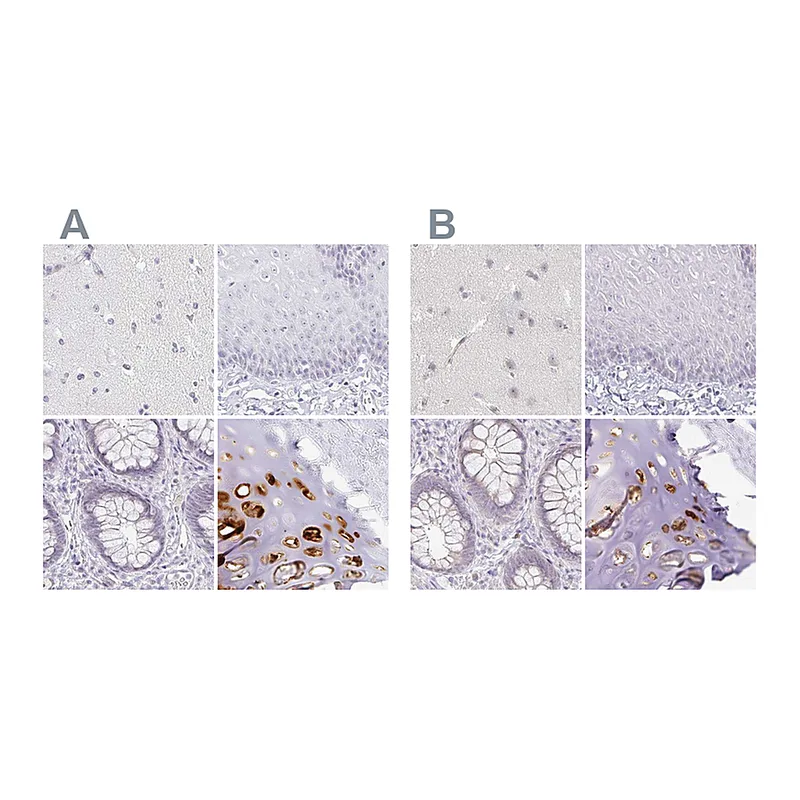 Atlas Antibodies Anti-ACAN Antibody